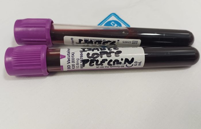 el dia 19.12.024, tenia lugar en el Hospital de Calella, la primera extracción de muestra (tejido y sangre) que daba inicio y creación del Biobanco de tejido del síndrome de la persona rigida, Biobanco de muestras del Ciberer en Valencia.