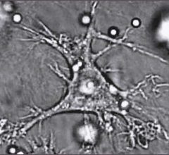 dendritic cell