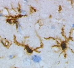 microglia